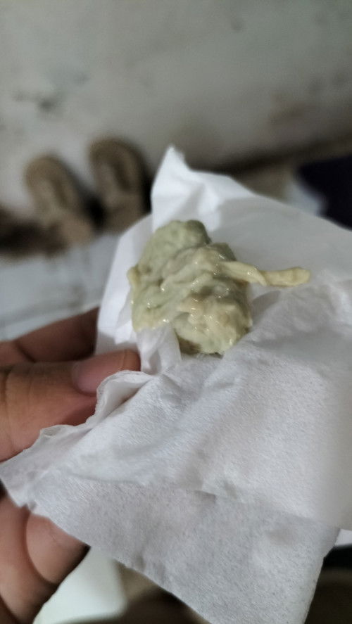 Maaf bun share foto krg baik,ad yg sama stlah nifas lalu keputihan dan kluar sprti ini bun?