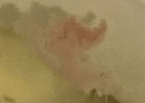 Normal ke lendir ada coklat macam ni? 13 minggu pregnancy . Saya dpt ubat duphaston dr doktor