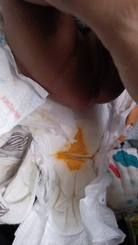 Baby 1 bulan 21 hari berak 2 hari sekali