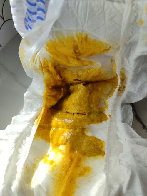 Baby 2 bulan berak acap kali