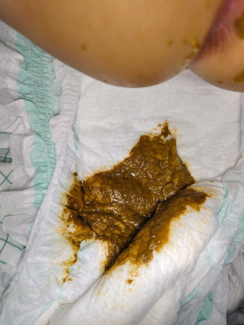 Normal lang po ba tong poop ng baby ko 1 year old po