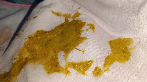 BAB bayi umur 28 hari warna kuning sedikit kehijauan dan seperti ada busanya