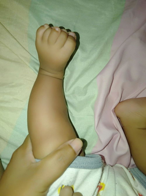 Kaki Pengkor atau bukan