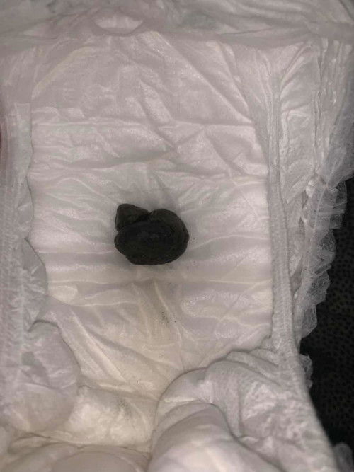 normal ke najis hitam