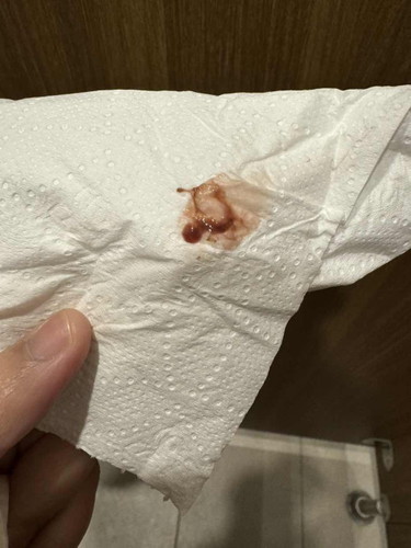 Ni tanda keguguran ke?