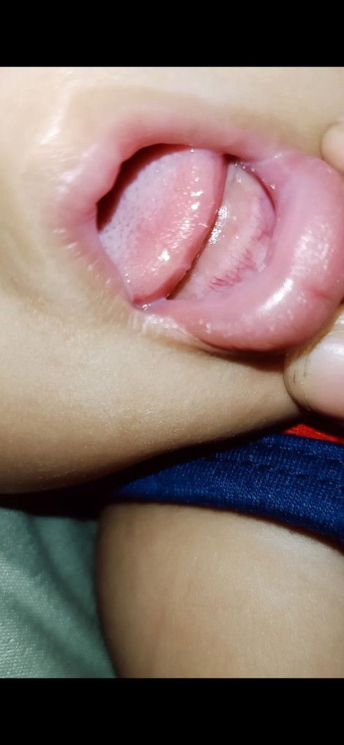 Ciri ciri tumgi pada anak usia 9bulan