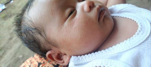 bintik bintik  kecil