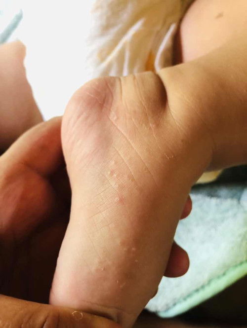 bayiku kenapa ya bund ??