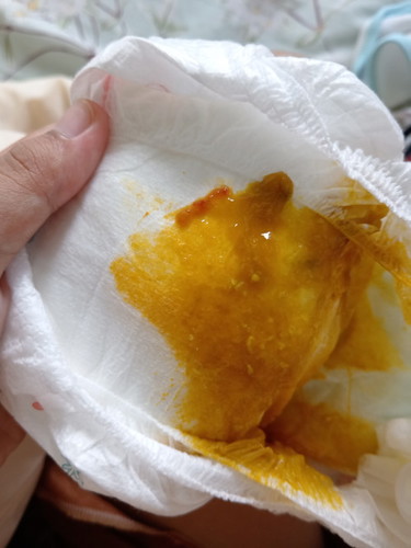 Bby klau berak ada darah sikit normal kh?