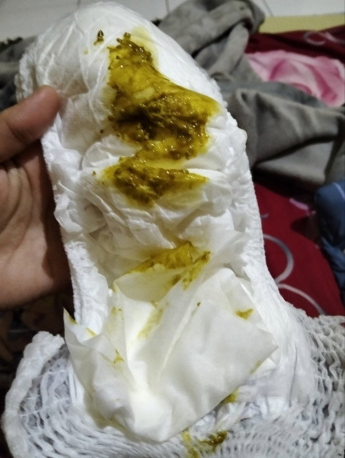 Pup hijau bayi