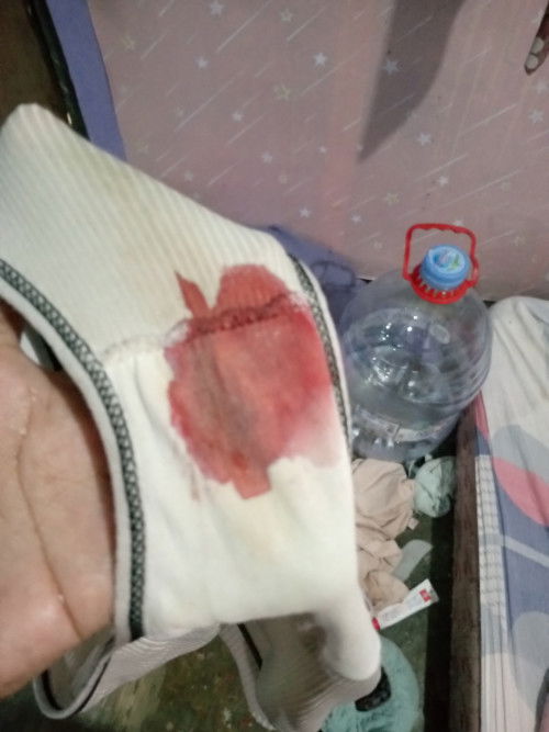 Keluar darah saat usia 6 minggu