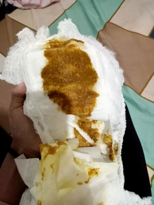 Bab mpasi 7 bln encer atau ambyar