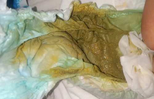 Greenish poop