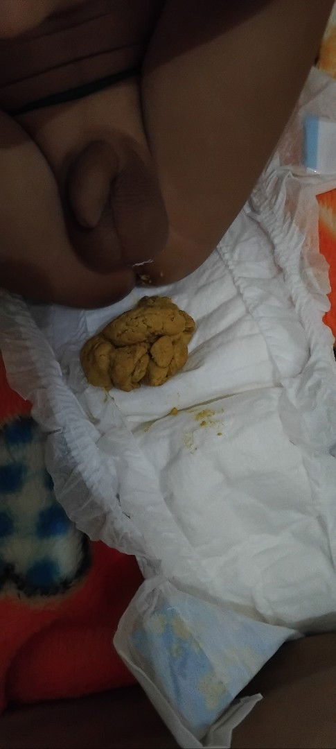 Pup bayi tidak encer