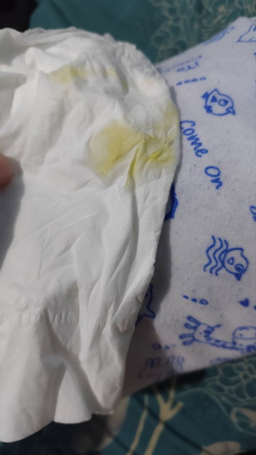 Cairan bening campur kuning