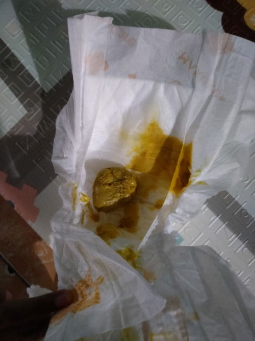 BAB bayi 5 bulan 4 hari