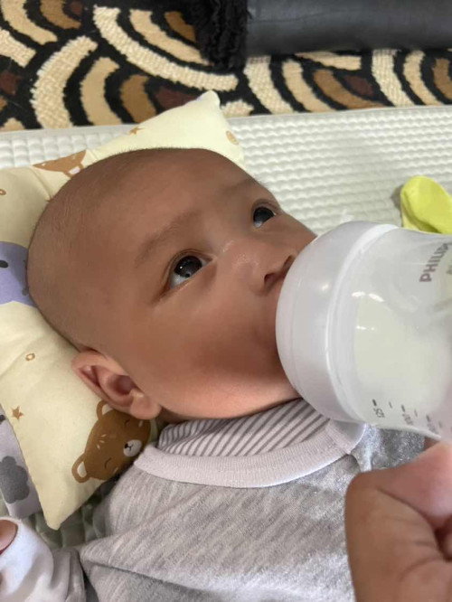 Bayi sering lihat keatas