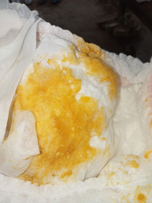 สอบถามแม่ๆเรื่องอึลูกน้อยค่ะ