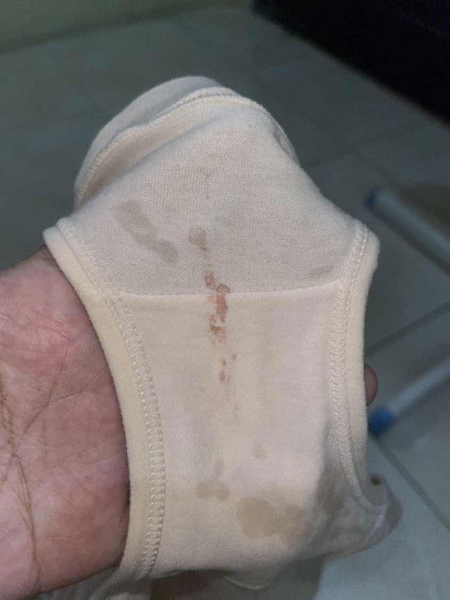 Bercak darah di 27w4d