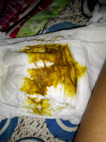 น้อง3เดือนอึเป็นมูก