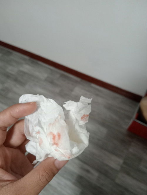 สอบถามเบื้องต้น