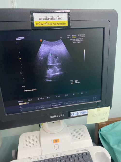 ท้องออกกันตอนกี่เดือนคะ