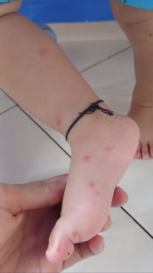 Bintik merah berisi air