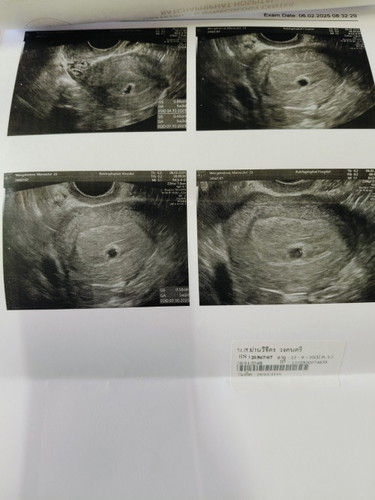 สอบถามแม่ๆที่เคยเจอเหตุการณ์แบบนี้ค่ะ