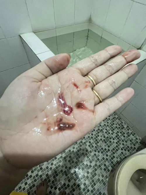 Ada yg sama ? Minta doanya bunda”