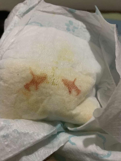 Pipis bayi ada bercak merah