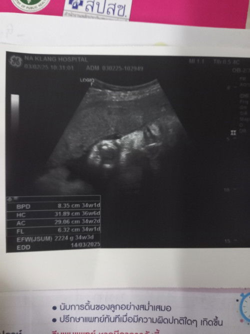 แม่ๆช่วยดูให้หน่อยค่ะ