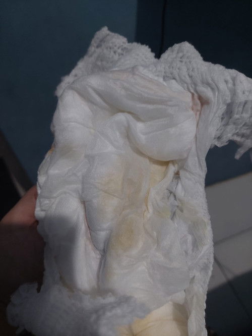 Warna pipis bayi 6 bulan 25 hari normal kah bun ?