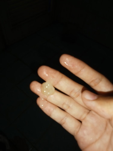 แบบนี้คือตกขาวหรือมูกหรอค่ะ