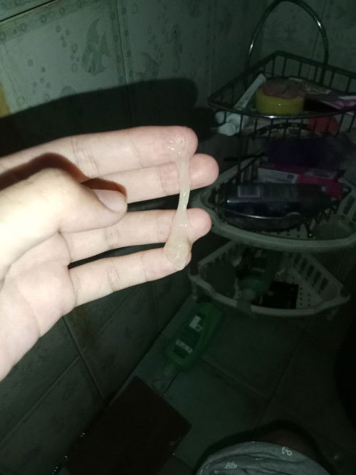 แบบนี้คือใกล้คลอดยังค่ะ หรือว่าแค่ตกขาว