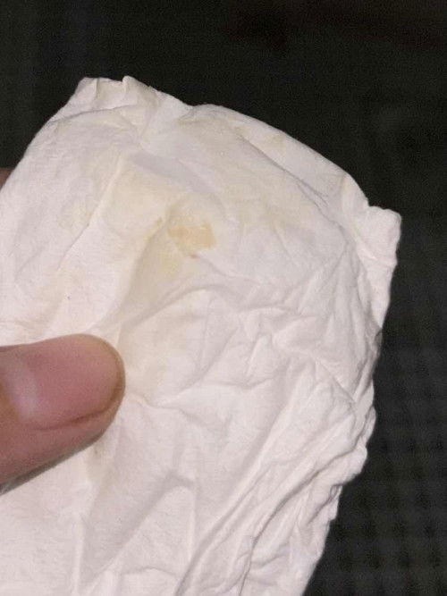 Apakah ini termasuk flek?