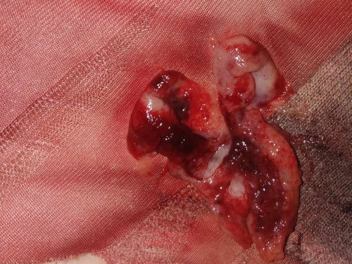 Tanong KO Lang Kasi 1st time KO makaranas Ng ganitong discharge while in period.