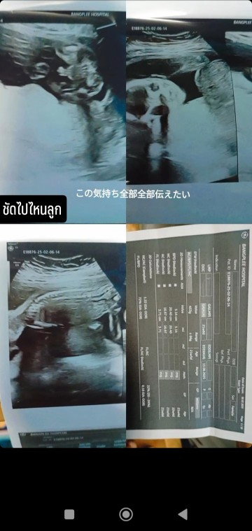 เกี่ยวกับน้ำหนักลูก