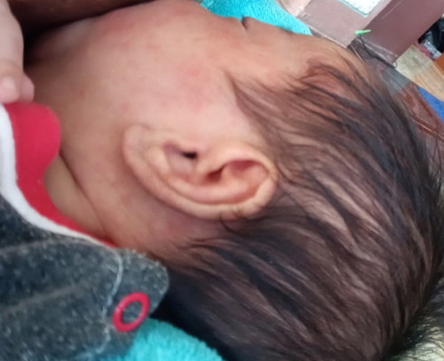 อิแม่คิดหนัก สงสารลูกจัง มีวิธีแนะนำหน่อยนะ