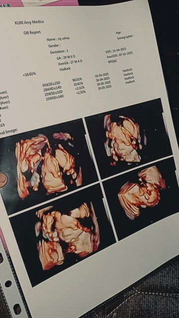 Bund mau nanya kalau usg tampilan bibirnya kaya gini itu normal kan yà bund?tips buat naikin bbj bun