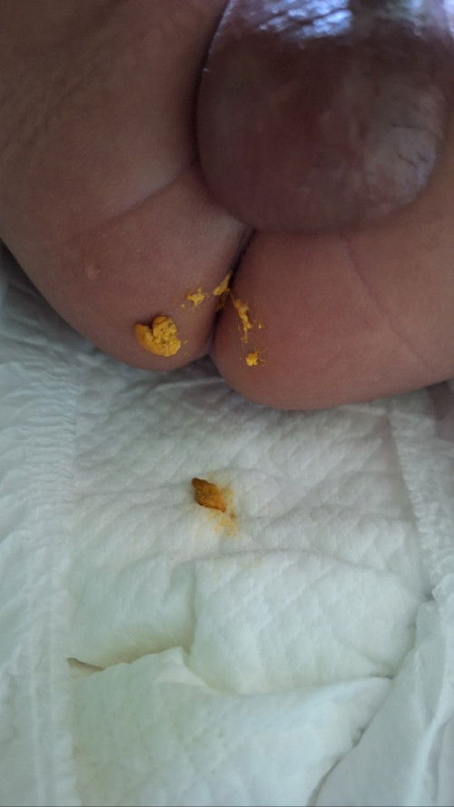 bayi 2 bulan pup keras