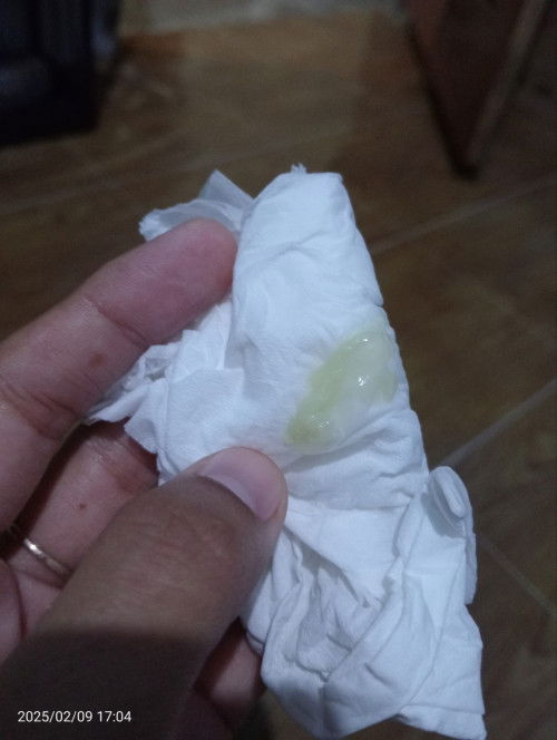 Dari semalam perut kenceng tapi masih hilang timbul.. dan sekarang keluar keputihan kaya gini Bun
