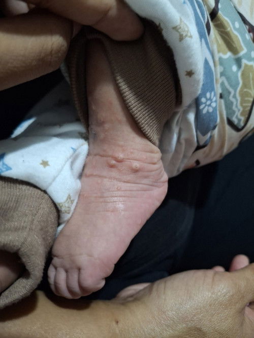 Bayi umur 33 hari