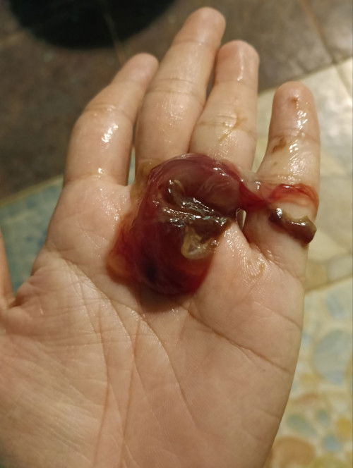 แบบนี้ควรไป รพ.มั้ยคะ