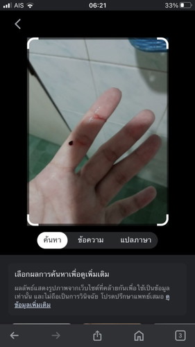 ท้อง10wมีเลือดออก