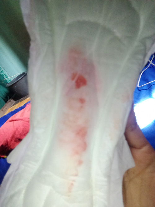 Kehamilan 6 week 6 d