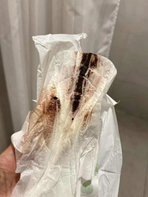 Flek Saat Kehamilan Usia 4-5 Week