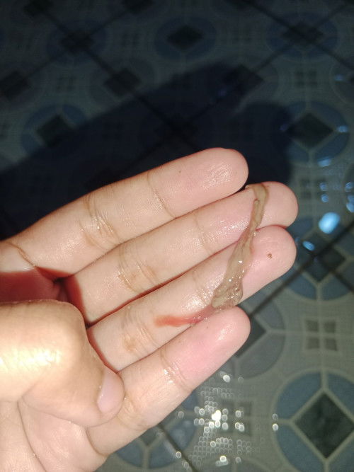 lendir cokelat apakah janin?