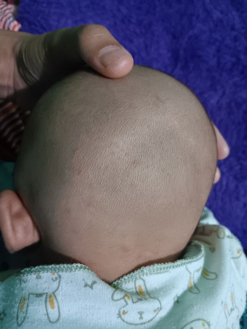 Kepala bayi usia 2 bulan