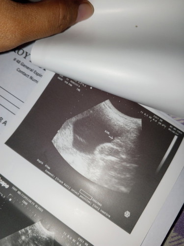 26 weeks and 3 days Breech Position