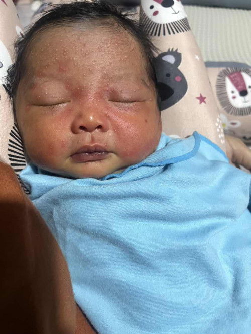 Ada yang ngalamin anak bintik bgini gak